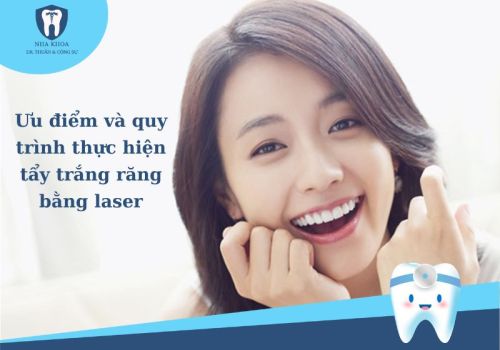 Tìm hiểu ưu điểm và quy trình thực hiện tẩy trắng răng bằng laser