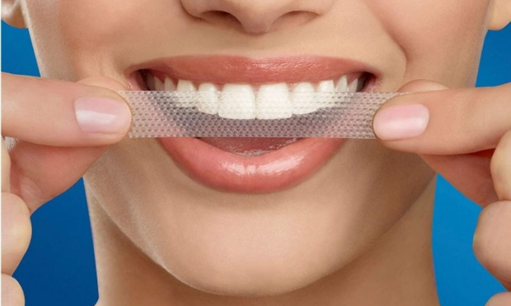 cách làm trắng răng nhanh nhất