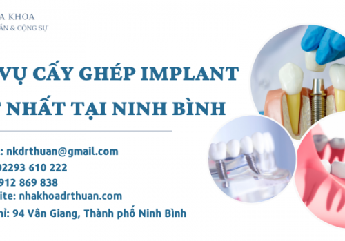 Dịch Vụ Cấy Ghép Implant Uy Tín Hàng Đầu Tại Ninh Bình