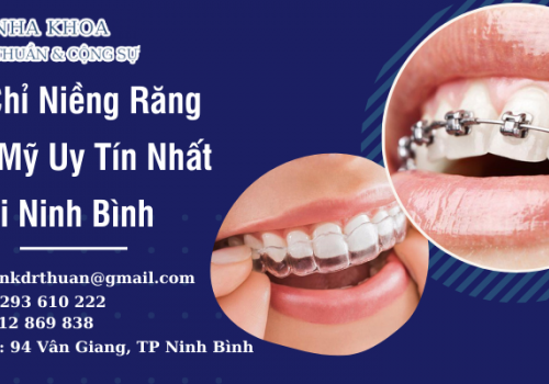 Địa Chỉ Niềng Răng Thẩm Mỹ Uy Tín Nhất Tại Ninh Bình