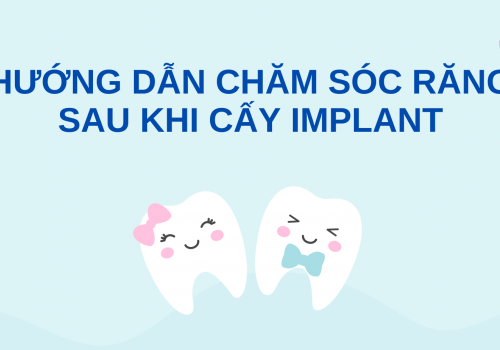 Hướng dẫn chăm sóc răng sau khi cấy implant