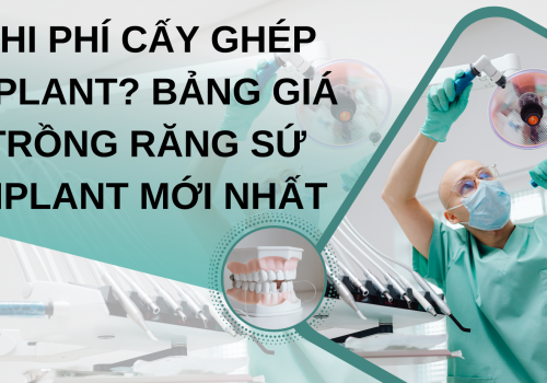 Cách tính chi phí cấy ghép implant? Bảng giá trồng răng sứ implant mới nhất