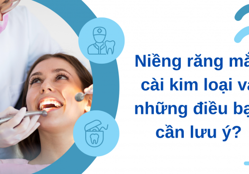 Niềng răng mắc cài kim loại và những điều bạn cần lưu ý?