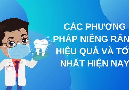 Các phương pháp niềng răng hiệu quả và tốt nhất hiện nay