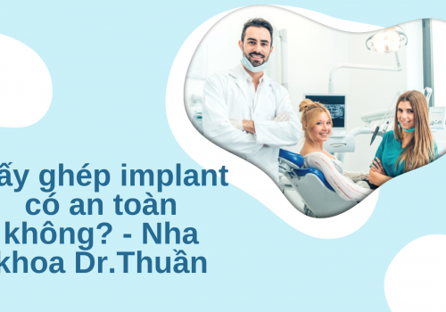 Cấy ghép implant có an toàn không? – Nha khoa Dr.Thuần