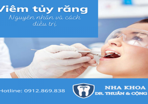 Điều trị viêm tủy răng – Nha khoa Dr Thuần & Cộng sự