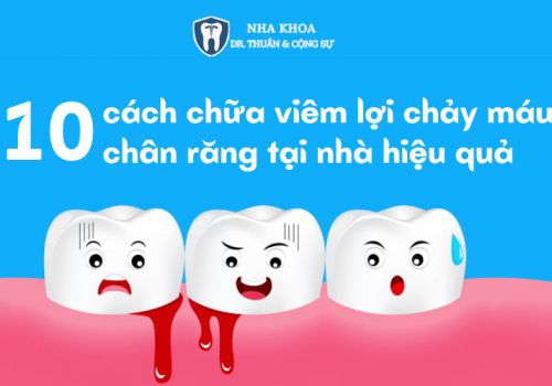 10 cách chữa viêm lợi chảy máu chân răng tại nhà hiệu quả