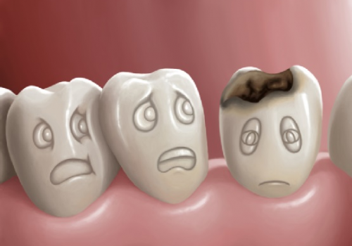 Nguyên nhân đau răng và cách chăm sóc đơn giản