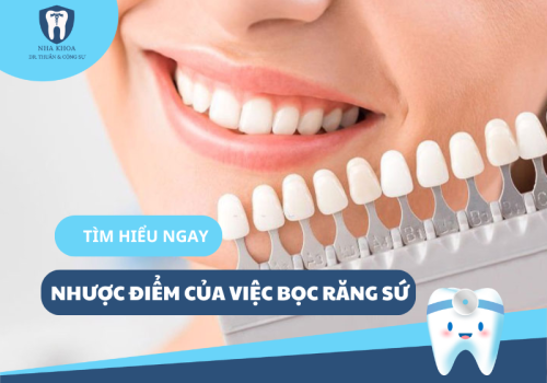 5 NHƯỢC ĐIỂM CỦA VIỆC BỌC RĂNG SỨ - LỜI KHUYÊN TỪ CÁC CHUYÊN GIA