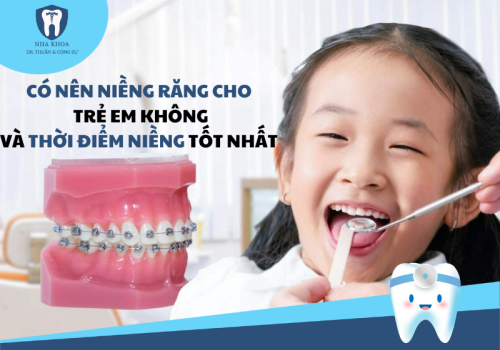 CÓ NÊN NIỀNG RĂNG CHO TRẺ EM KHÔNG? ĐỘ TUỔI NIỀNG RĂNG TỐT NHẤT