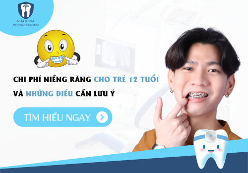 Giá niềng răng cho trẻ 12 tuổi là bao nhiêu và những điều cần biết 