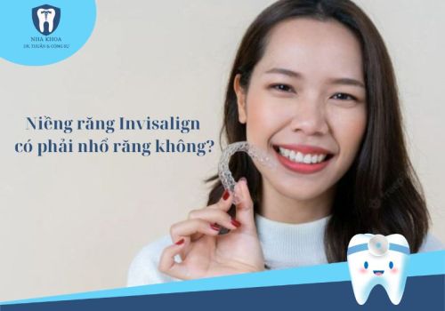 Niềng răng Invisalign có phải nhổ răng không? Vì sao?