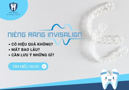 Niềng răng invisalign có hiệu quả không? Mất bao lâu và cần lưu ý những gì? 