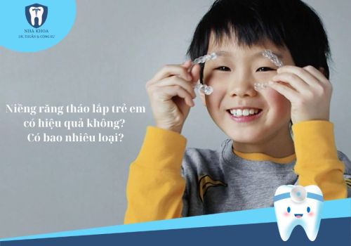 Niềng răng tháo lắp trẻ em có hiệu quả không? Có bao nhiêu loại?