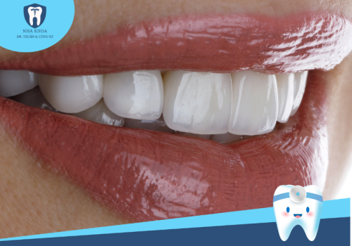 Bọc răng sứ là gì? Những lợi ích khi bọc răng sứ?
