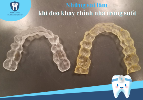 Những sai lầm khi đeo khay chỉnh nha trong suốt bạn nên lưu ý