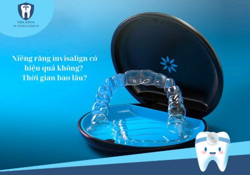 Niềng răng invisalign có hiệu quả không? Thời gian bao lâu?