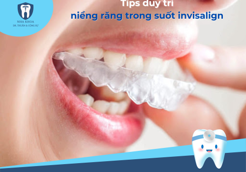 Hướng dẫn tips duy trì niềng răng trong suốt invisalign hiệu quả