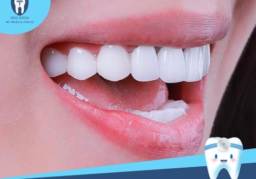Tác hại của tẩy trắng răng nếu quá lạm dụng không phải ai cũng biết
