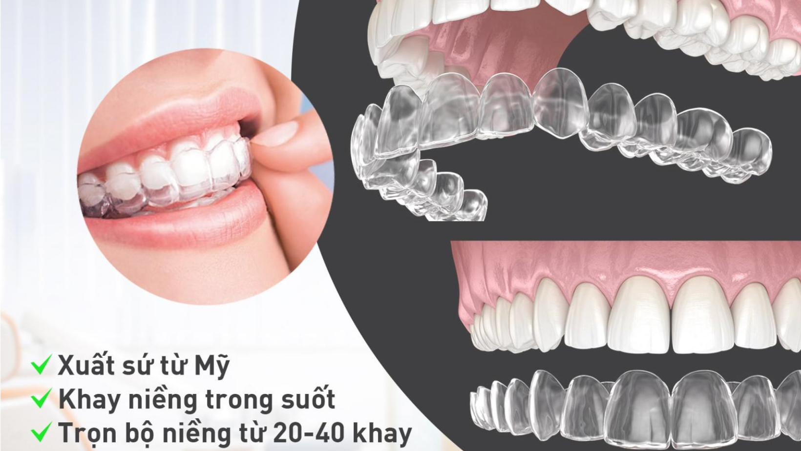 niềng răng invisalign