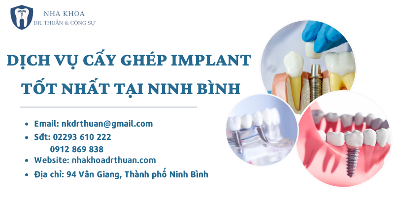 cấy ghép Implant