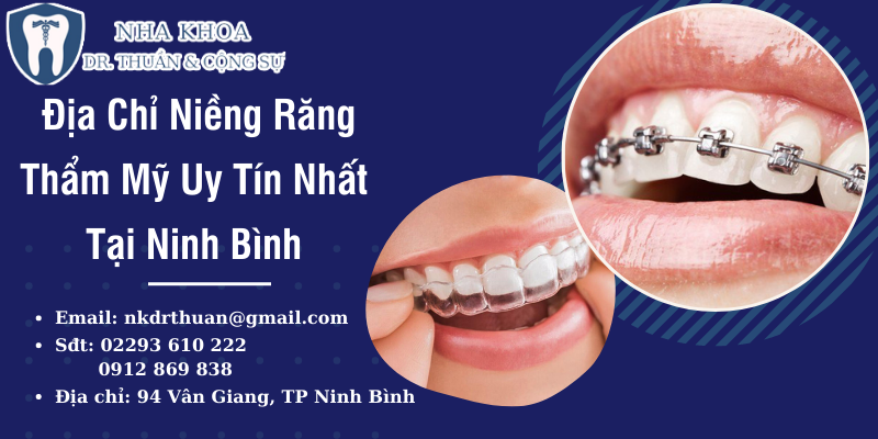 niềng răng thẩm mỹ