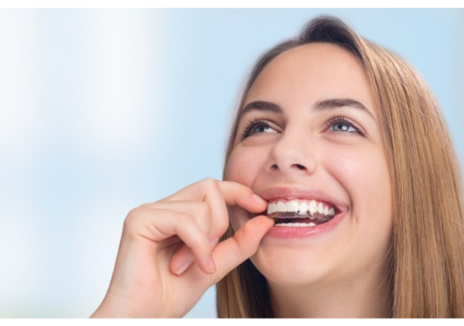 niềng răng invisalign