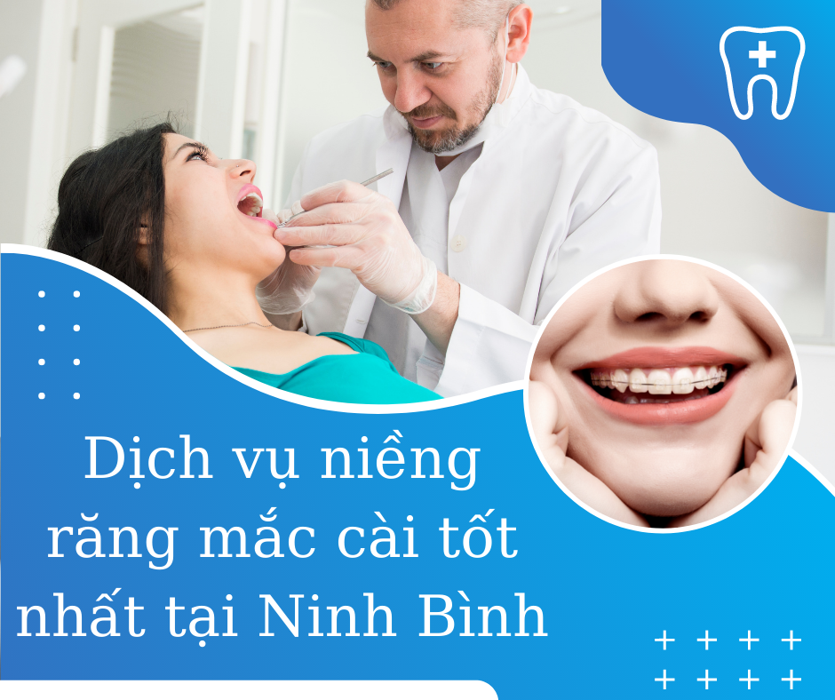 niềng răng mắc cài