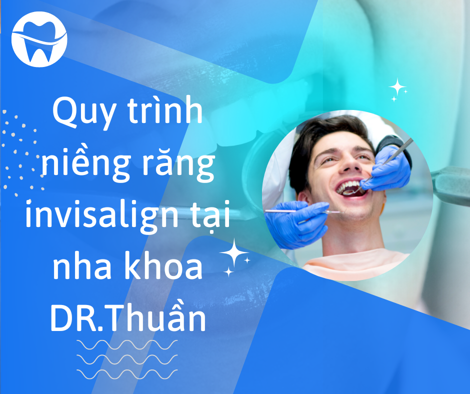 quy trình niềng răng invisalign