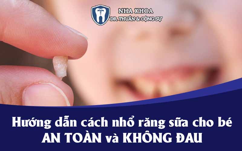 cách nhổ răng sữa cho bé