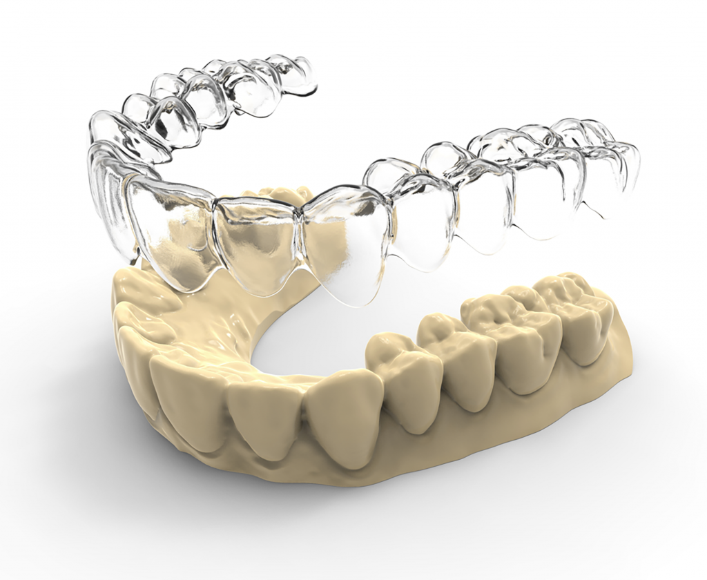 niềng răng 3d clear và invisalign