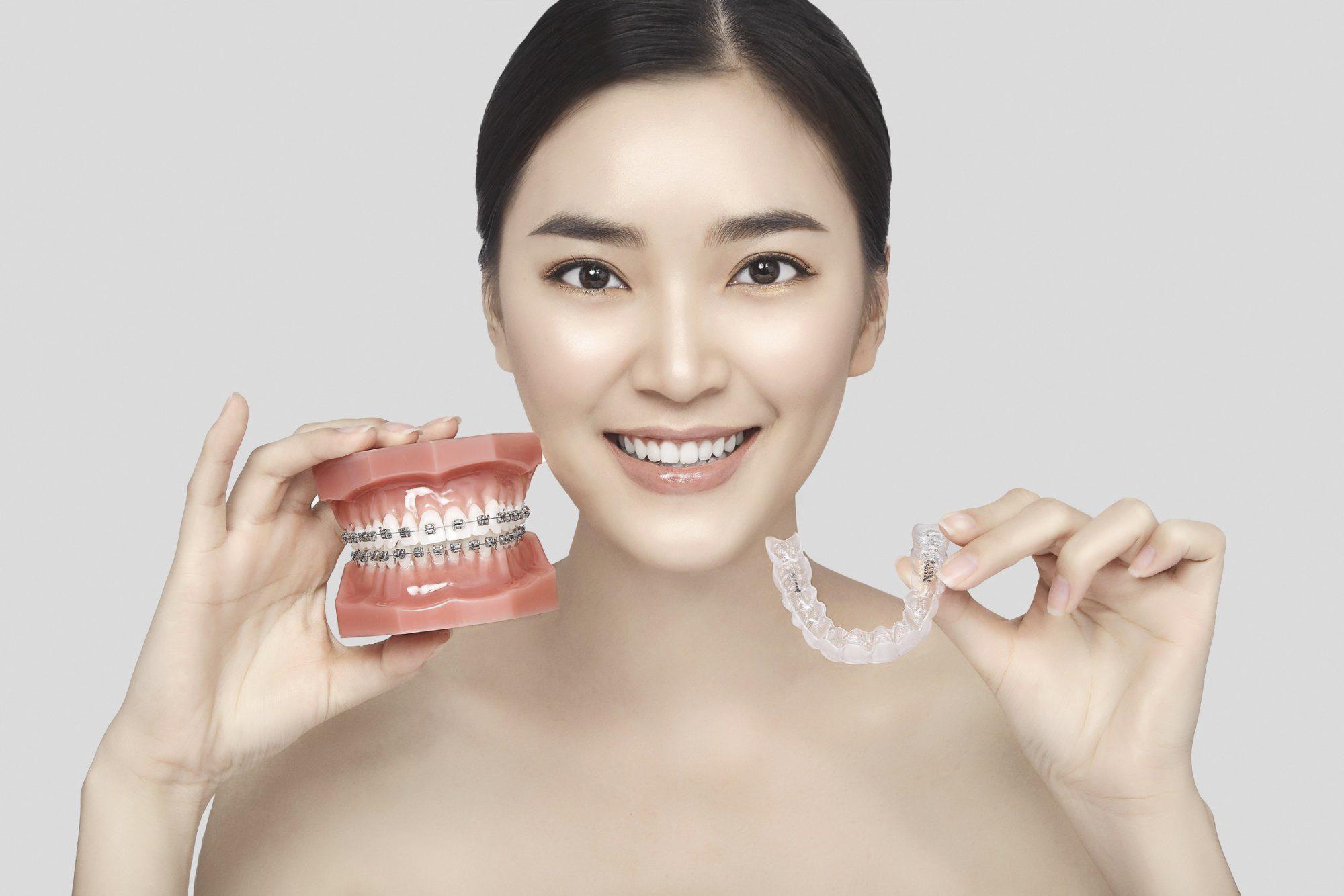 chi phí niềng răng invisalign