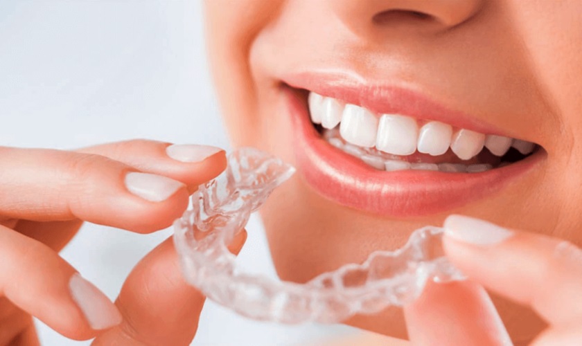 niềng răng 3d clear và invisalign