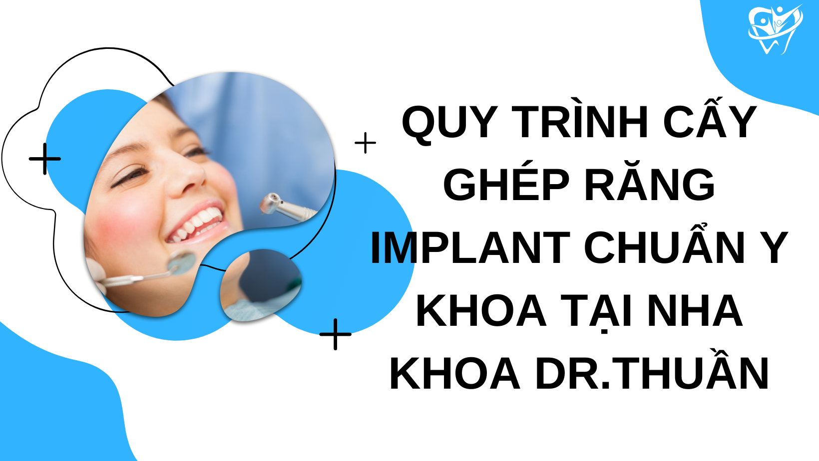 quy trình cấy ghép răng implant