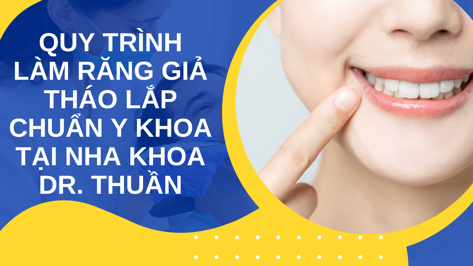 quy trình làm răng giả tháo lắp