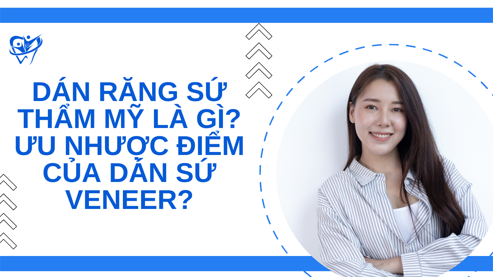 dán răng sứ thẩm mỹ