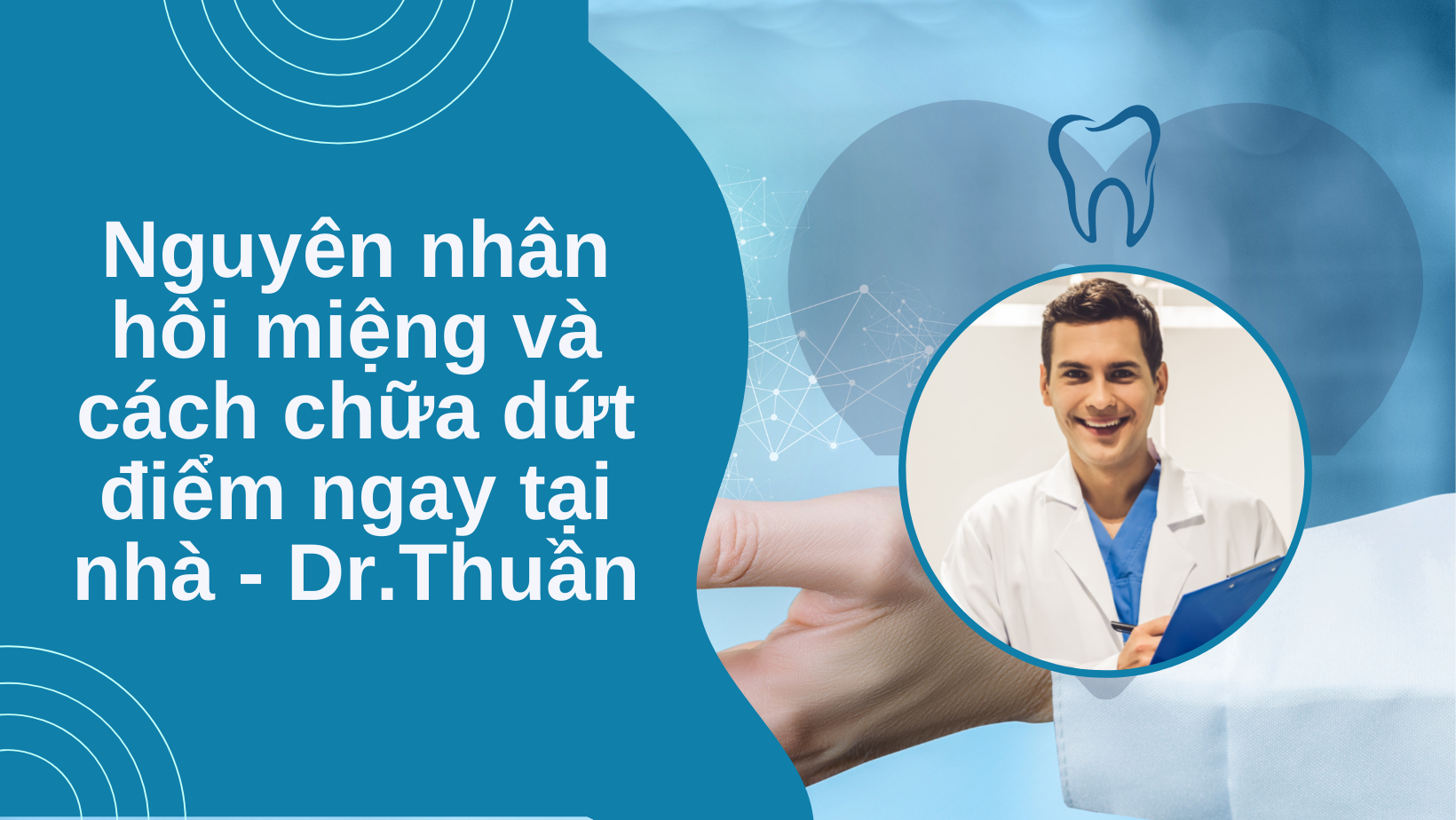 hôi miệng và cách chữa