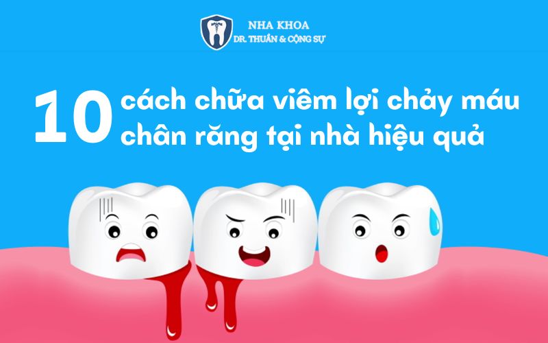 cách chữa viêm lợi chảy máu chân răng