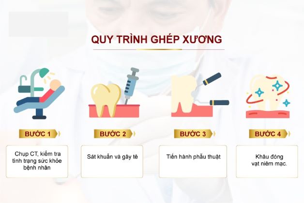 ghep xuong trong cay ghep implant 03