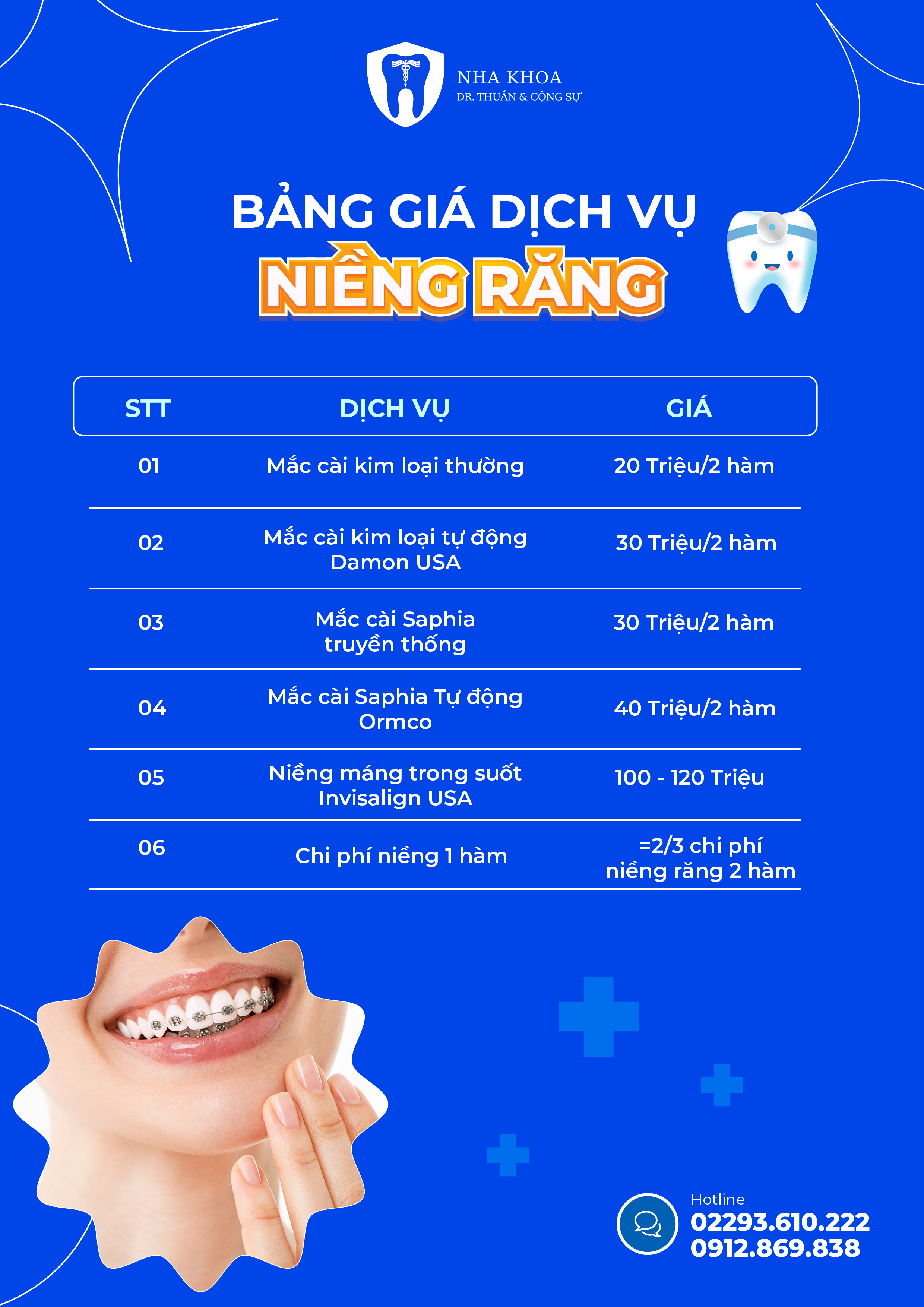 Bảng giá dịch vụ niềng răng tại ninh bình