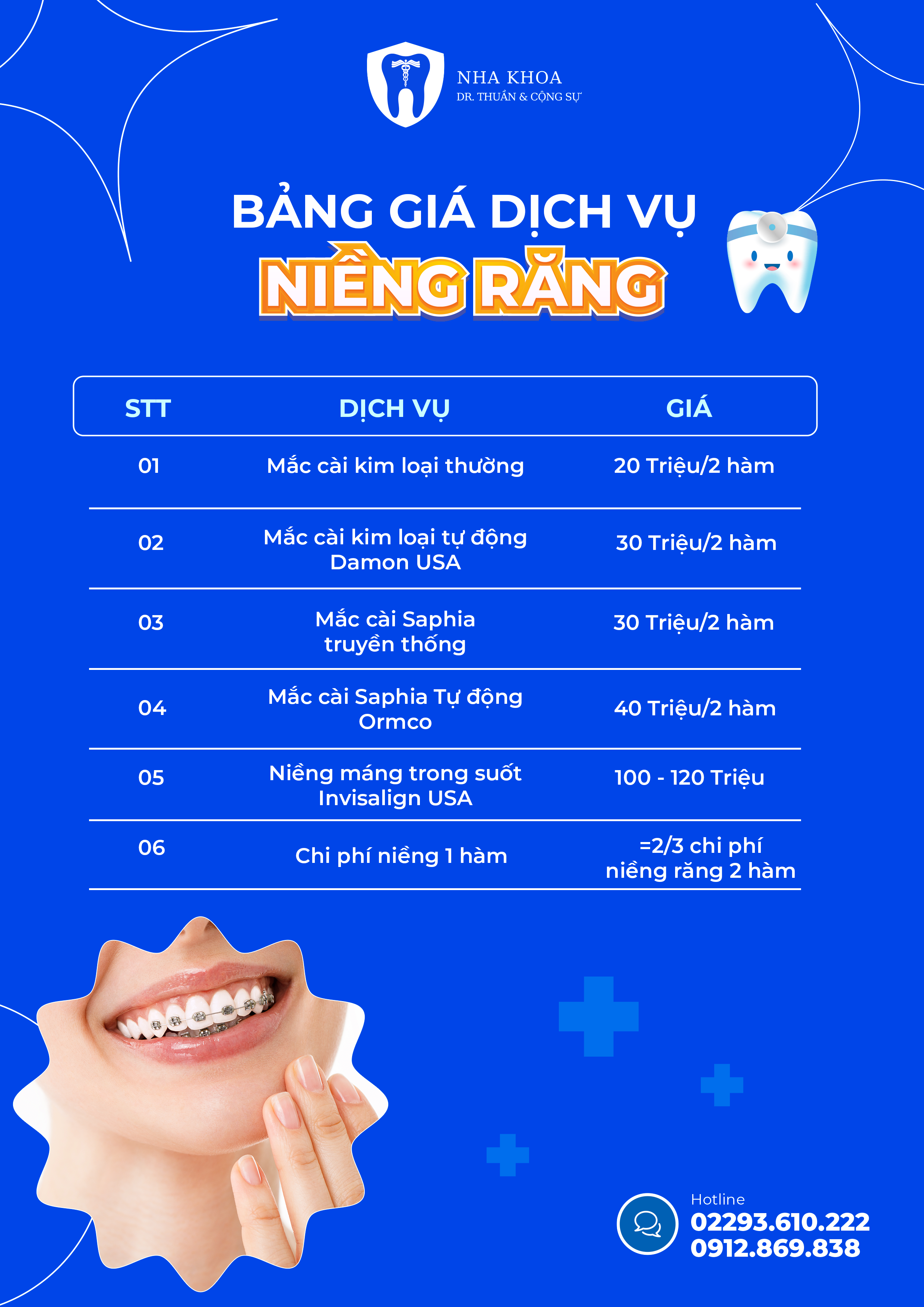 Bảng giá dịch vụ niềng răng tại ninh bình_1