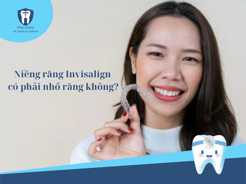 Niềng răng Invisalign có phải nhổ răng không