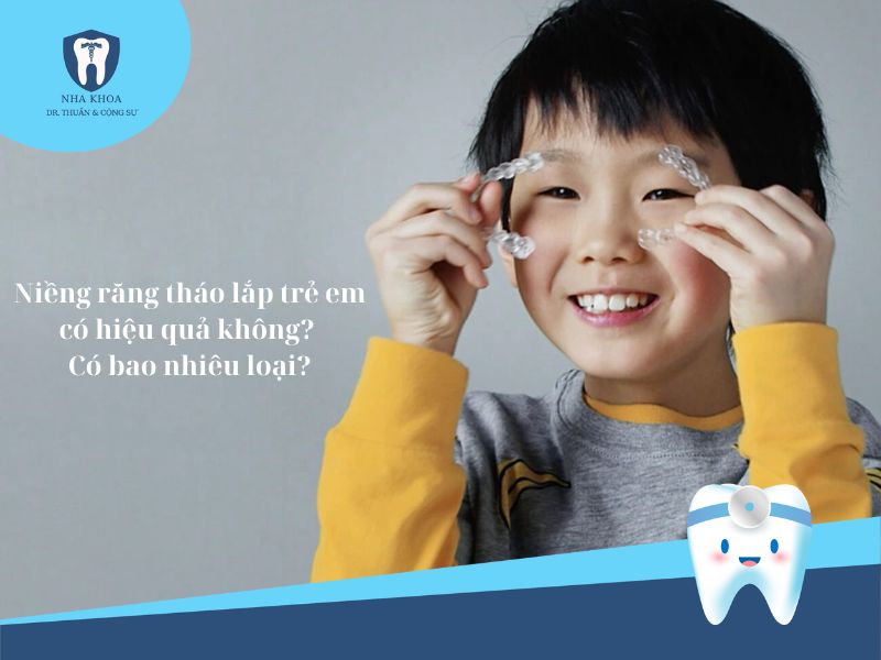 Niềng răng tháo lắp trẻ em