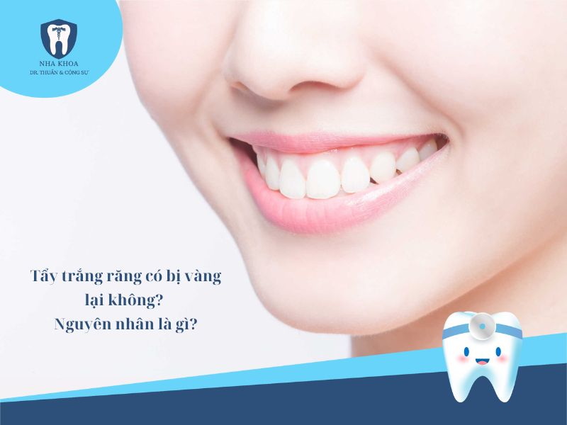 Tẩy trắng răng có bị vàng lại không Nguyên nhân là gì