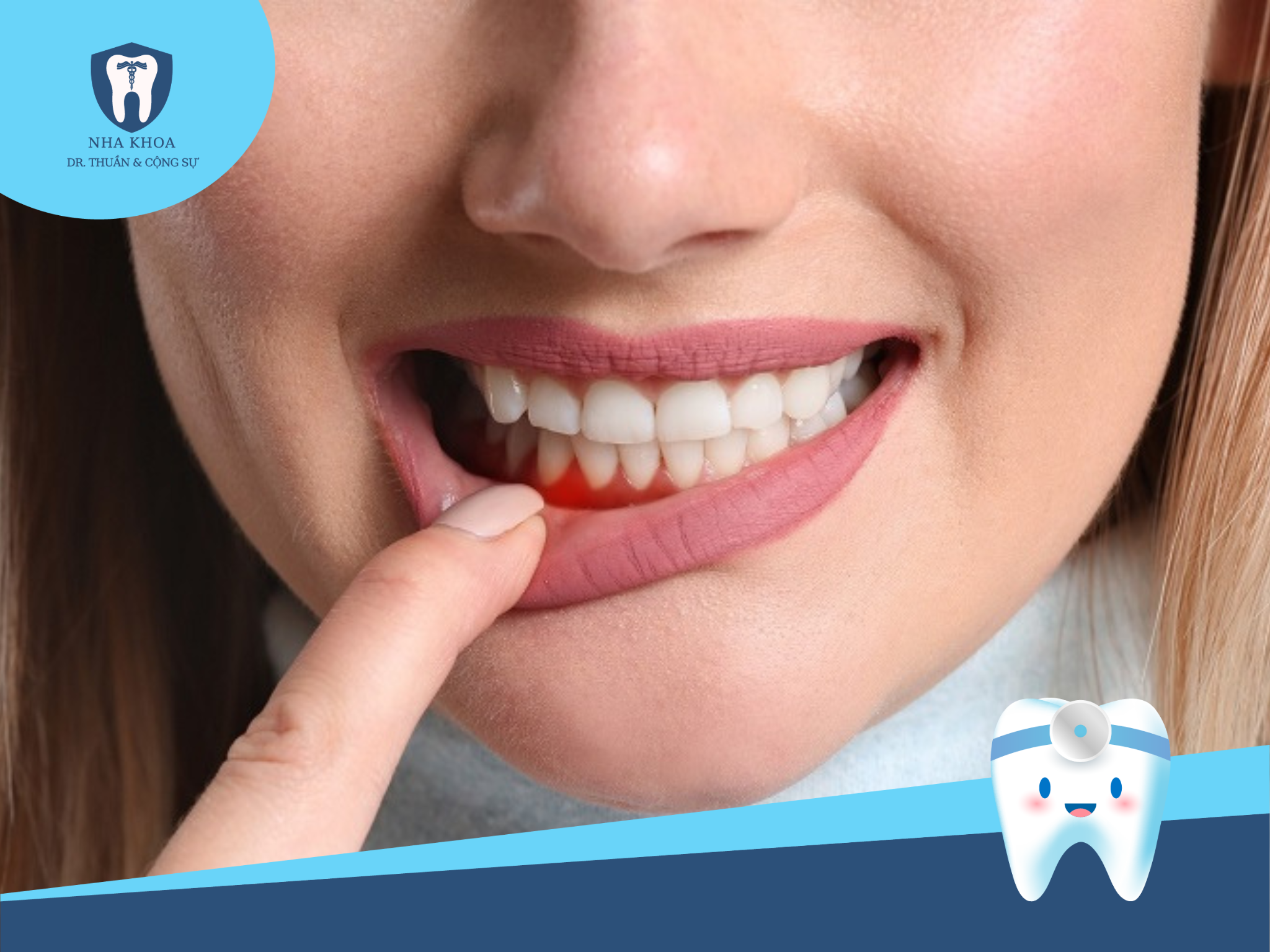 Các nguyên nhân gây viêm nha chu thường bắt nguồn từ vệ sinh răng miệng kém.