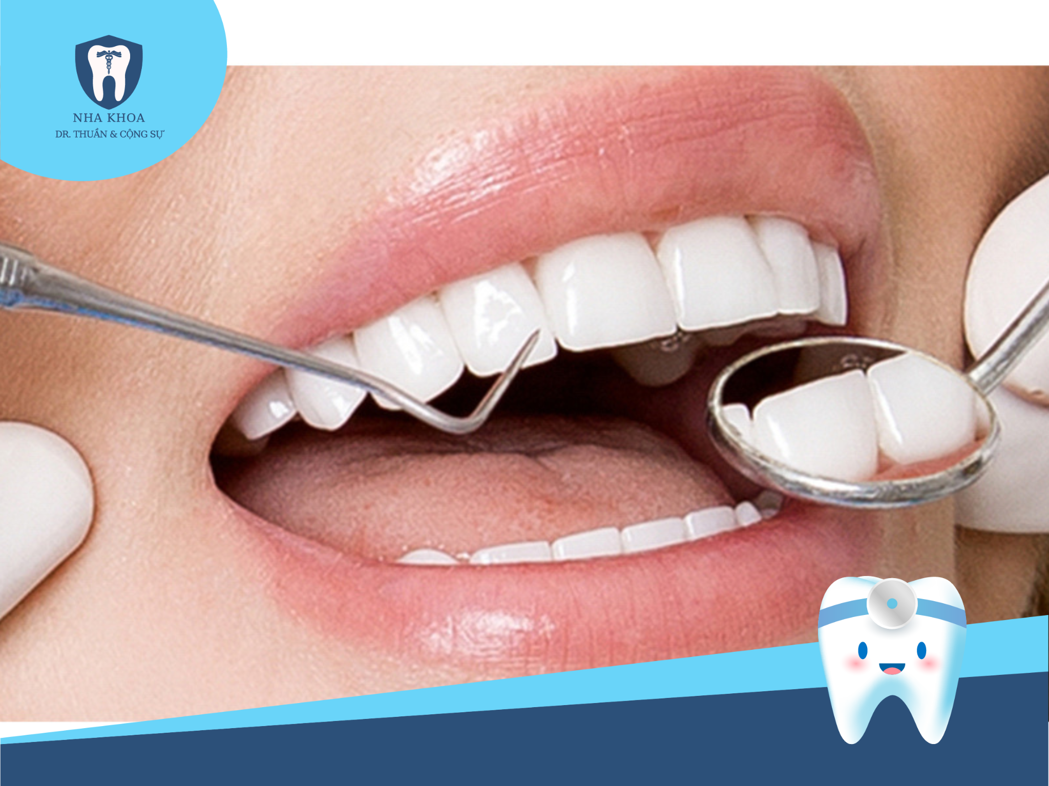 Theo thống kê, độ bền của răng sứ có thể lên đến 20 năm nếu được thực hiện và chăm sóc đúng cách.