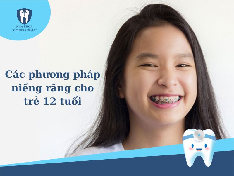 niềng răng cho trẻ 12 tuổi