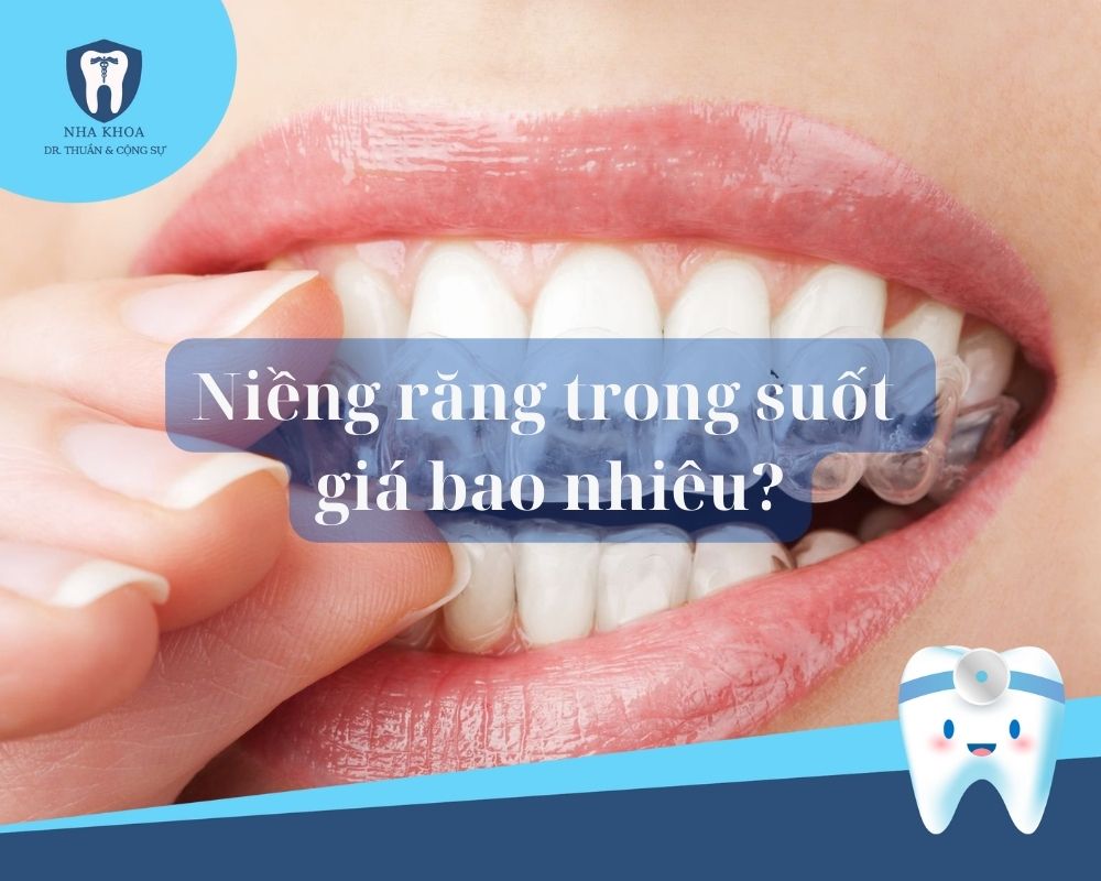 nieng-rang-trong-suot-gia-bao-nhieu