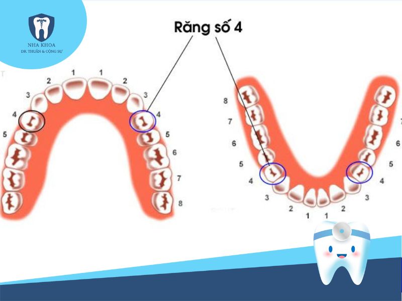 trường hợp phải nhổ răng khi niềng răng invisalign