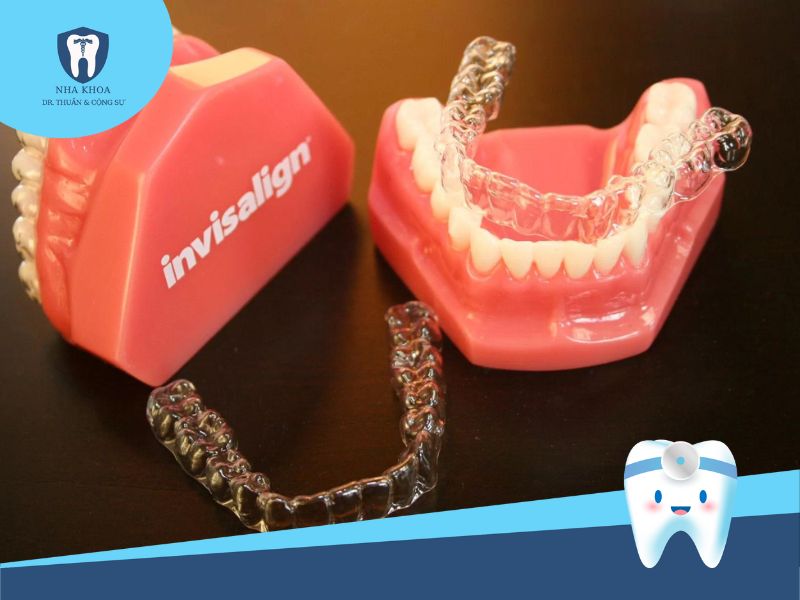 vì sao niềng răng invisalign không hiệu quả